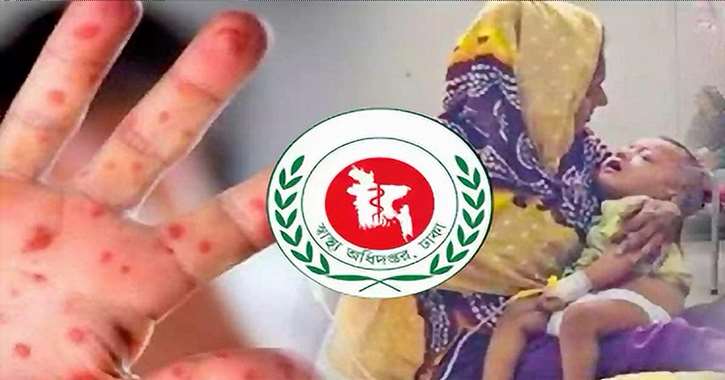 দেশে হামে আরও ৫ শিশুর মৃত্যু, মোট মৃত ৫৬০