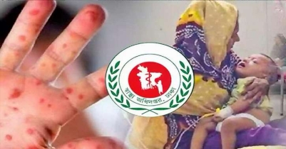 দেশে হামে আরও ৫ শিশুর মৃত্যু, মোট মৃত ৫৬০ দেশে হামে আরও ৫ শিশুর মৃত্যু, মোট মৃত ৫৬০