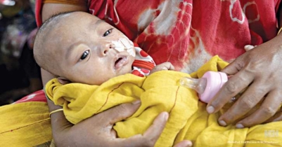 হামের উপসর্গে ২৪ ঘণ্টায় ৪ জনের মৃত্যু হামের উপসর্গে ২৪ ঘণ্টায় ৪ জনের মৃত্যু